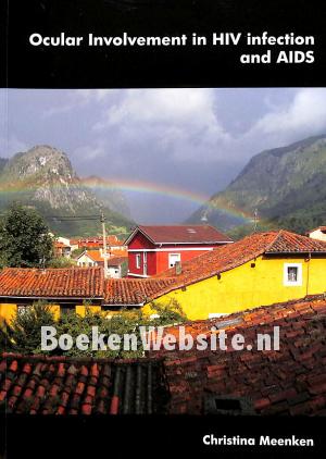 Ocular Involvement in HIV infection and AIDS Ocular Involvement in HIV infection and AIDS