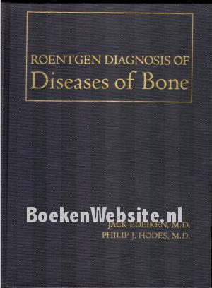 Roentgen Diagnosis of Diseases of Bone