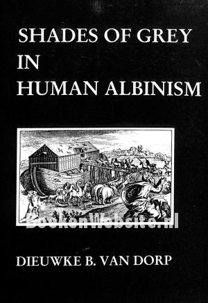 Shades of Grey in Human Albinism Shades of Grey in Human Albinism