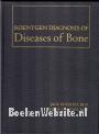 Roentgen Diagnosis of Diseases of Bone